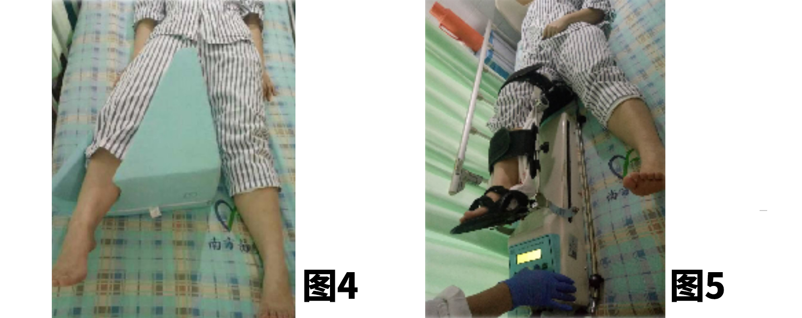 <!--HAODF:8:rengongguanjiezhihuanshu-->关节置换<!--HAODF:/8:rengongguanjiezhihuanshu-->的康复很重要：髋<!--HAODF:8:rengongguanjiezhihuanshu-->关节置换<!--HAODF:/8:rengongguanjiezhihuanshu-->手术后平常该如何锻炼？