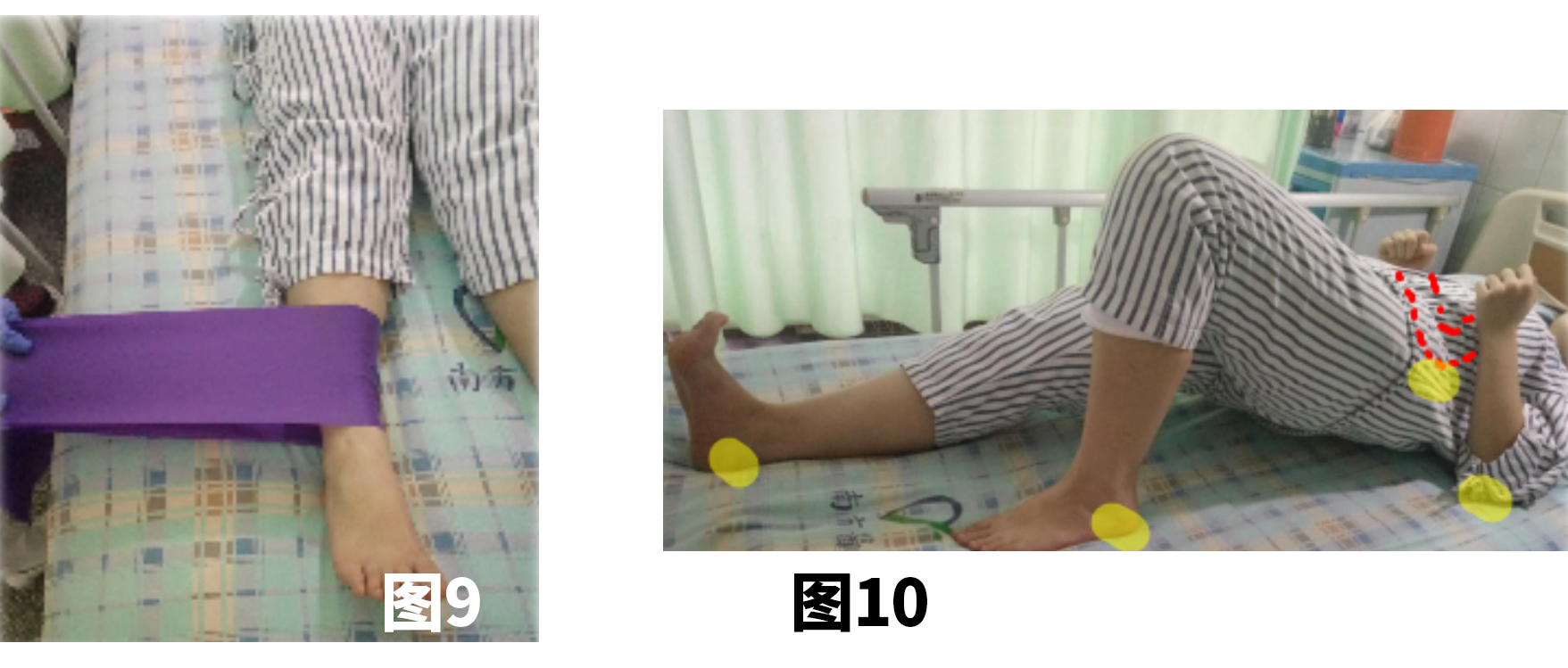 <!--HAODF:8:rengongguanjiezhihuanshu-->关节置换<!--HAODF:/8:rengongguanjiezhihuanshu-->的康复很重要：髋<!--HAODF:8:rengongguanjiezhihuanshu-->关节置换<!--HAODF:/8:rengongguanjiezhihuanshu-->手术后平常该如何锻炼？