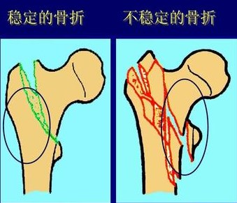 下载 (1).jpg
