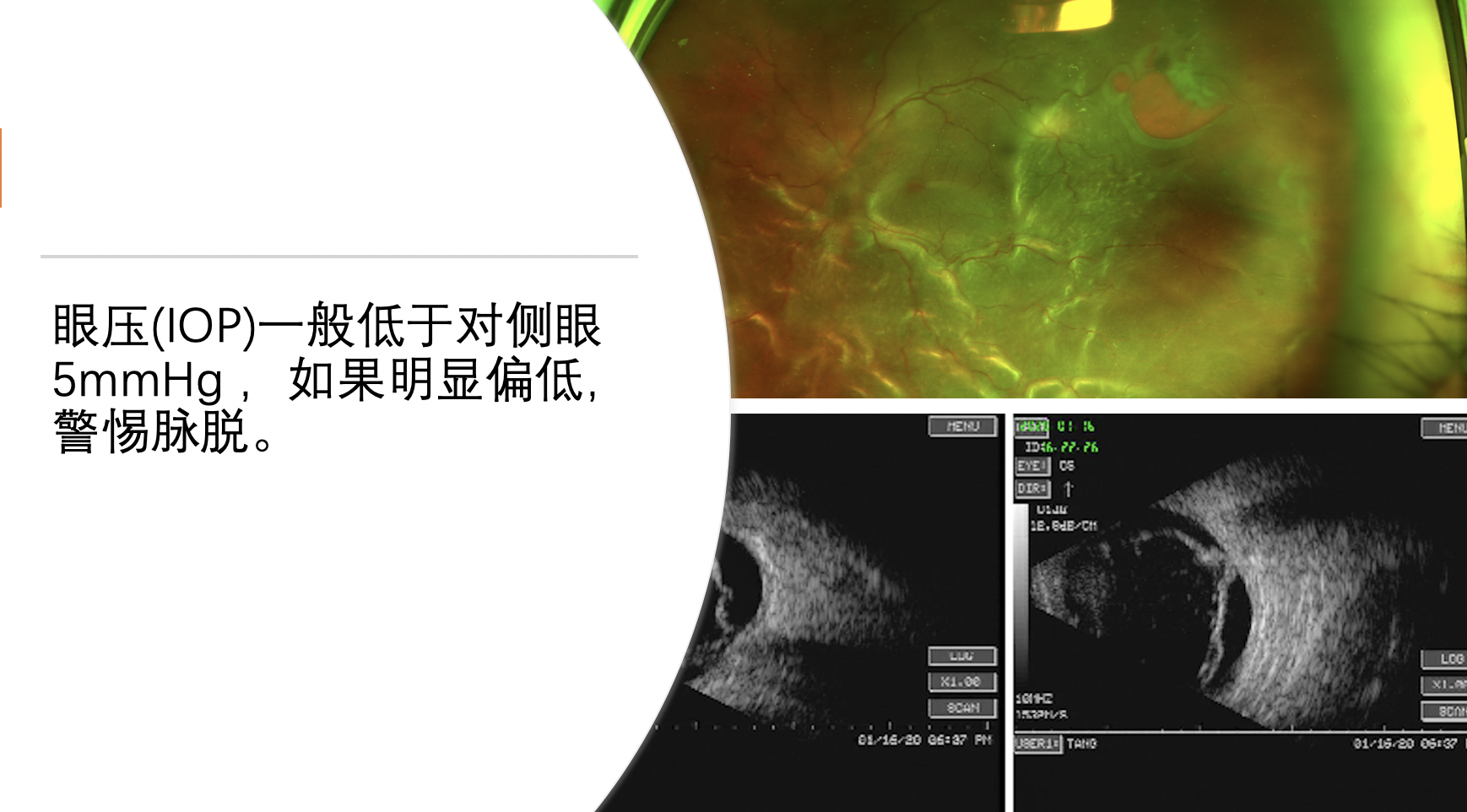 截屏2020-09-03 10.17.21.png