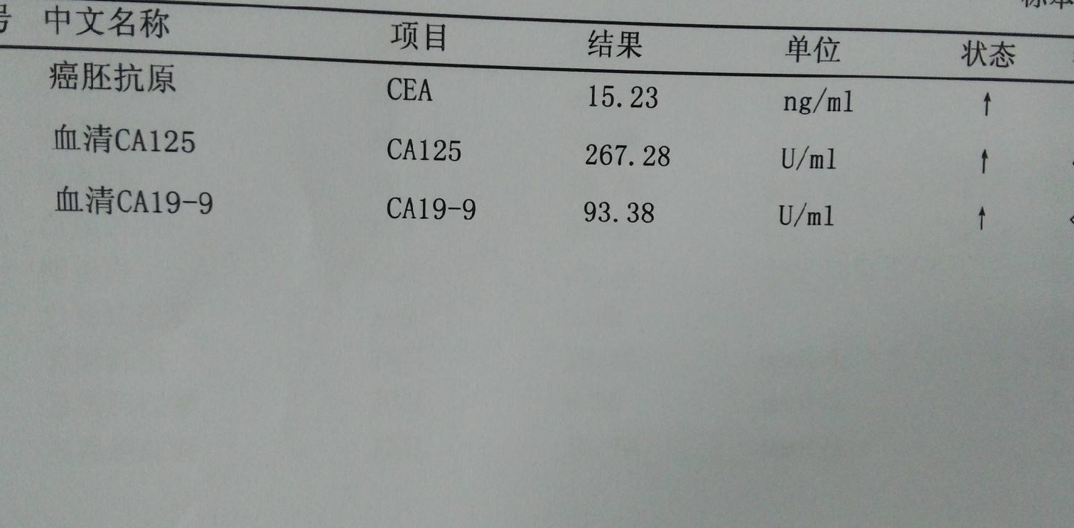 癌胚抗原高图片