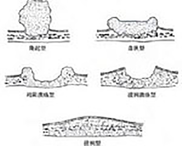 54d1797926e3286546.jpg
