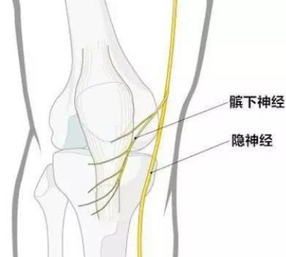 捕获.JPG