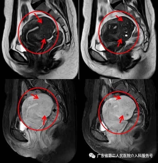 痛经8年，曾用多种方法未见效，此次是什么方法让她解决病痛？