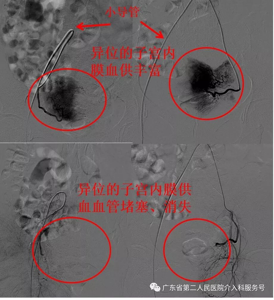痛经8年，曾用多种方法未见效，此次是什么方法让她解决病痛？