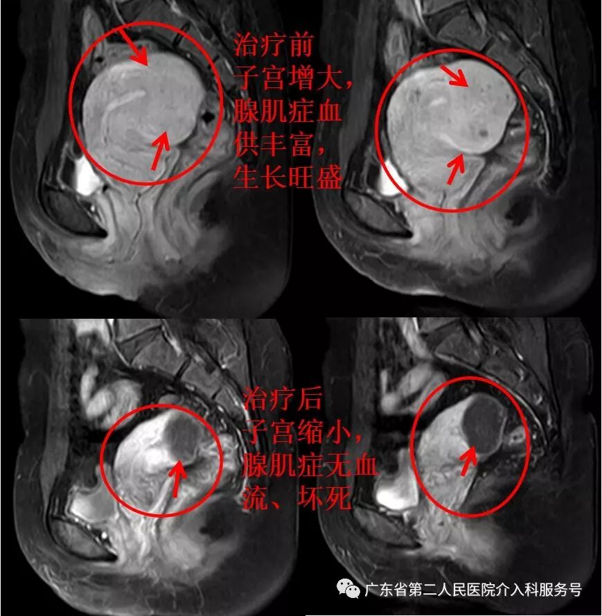 痛经8年，曾用多种方法未见效，此次是什么方法让她解决病痛？