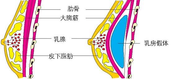u=1402265776,3493006455&fm=26&gp=0.jpg