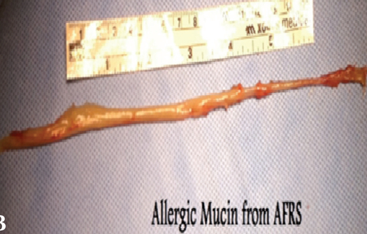 AFRS.jpg
