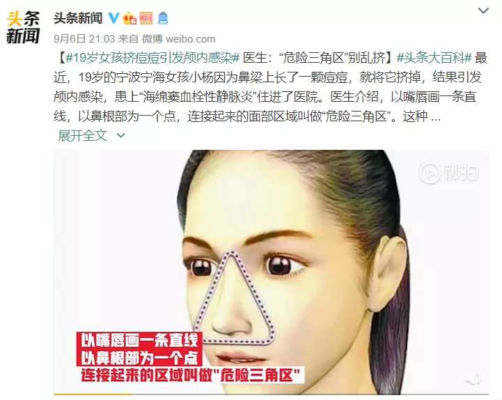 不想再反复长痘，可以试试这些中医药治疗方法