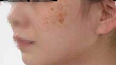 é»è¤æææè¿ç§é£ç©,å¸¸åç¥æè¿è½ç¾ç½