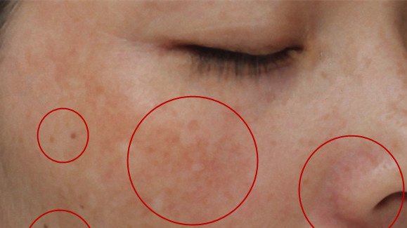 åè¯è¯ç¡®è®¤æå­ å­æåå¥½1ä»¶äº,ç¾ç½å»è¡,æ¸é¤é»è¤æ