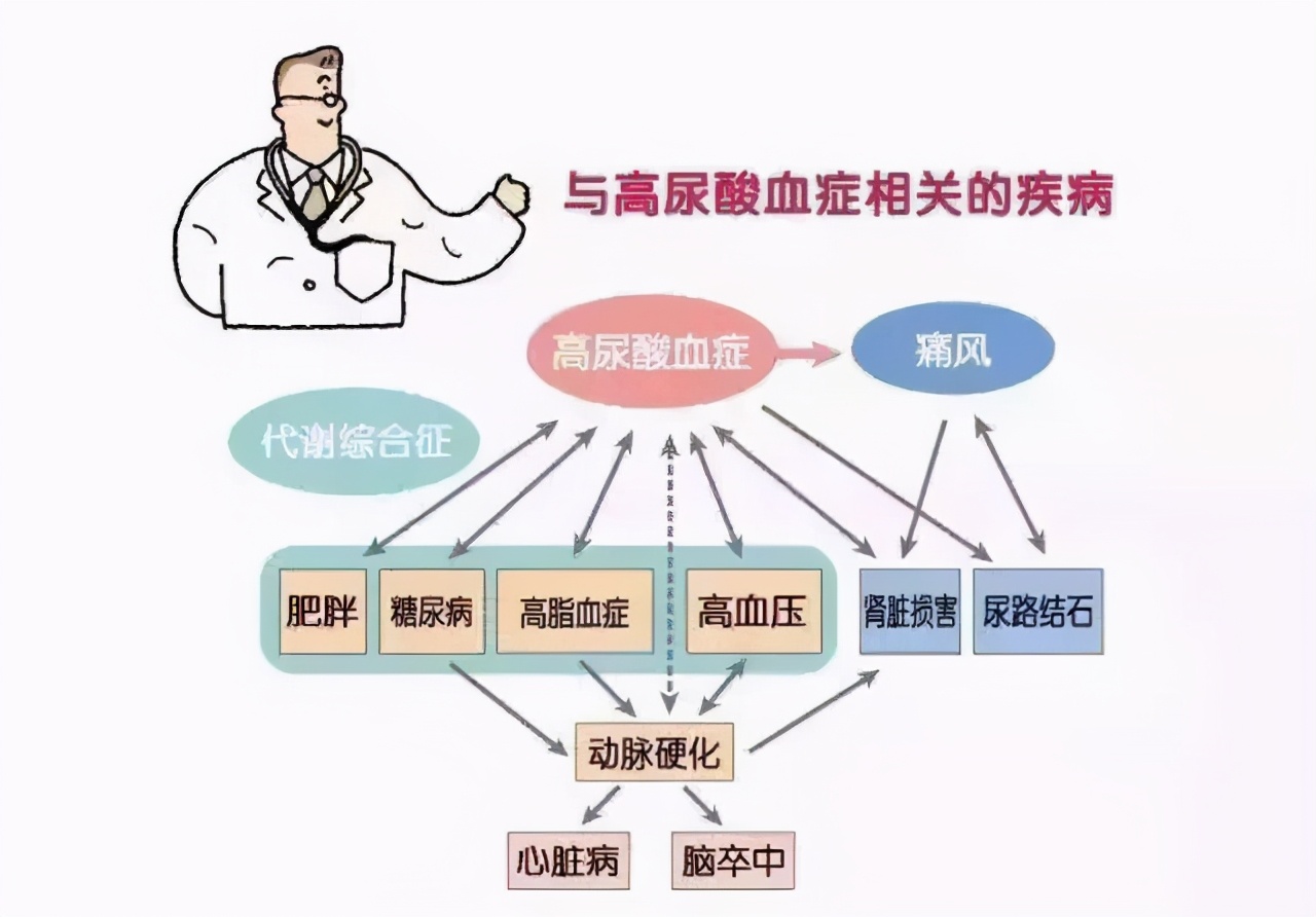 你是不是高尿酸血症最“喜欢”的人？