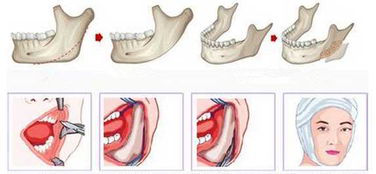 1605426817385881.png image.png