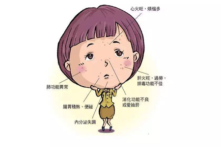 从中医上讲，痛风怎么治疗好？