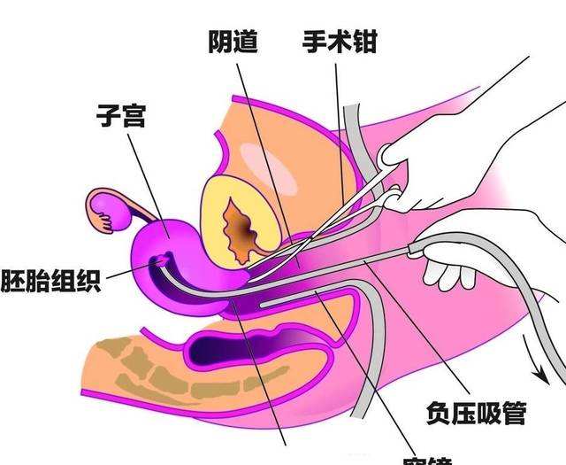 示意图.jpg