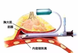 1607753545436270.png image.png