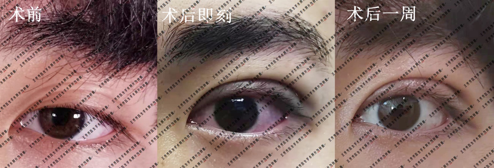 5d048c930e92cb07b5aa1b8b0d22ae7_副本.jpg