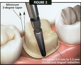 u=561384146,3757347771&fm=26&gp=0.jpg