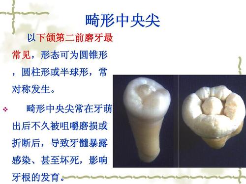 u=495304698,3461925289&fm=26&gp=0.jpg