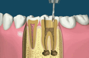6-1G2301510443I.gif