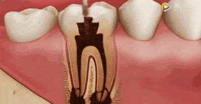 11.gif