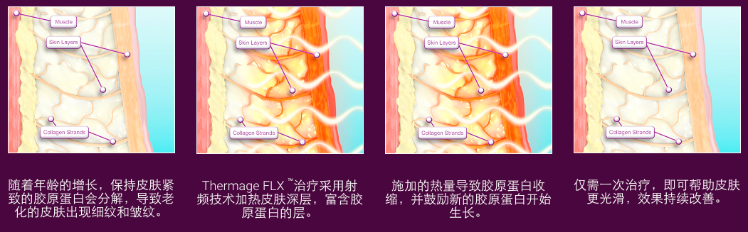 屏幕快照 2019-11-03 上午11.54.16.png