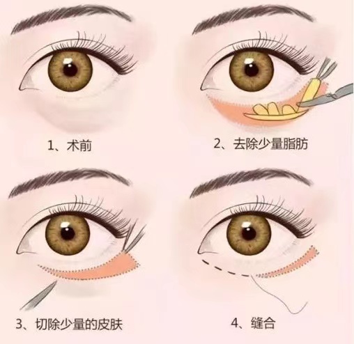 88ba88a3dde443204976c149f8f4394.jpg