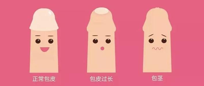 包皮过长.jpg