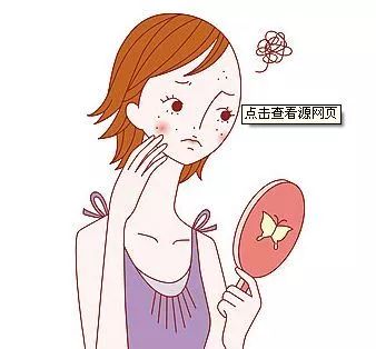 狼疮16.jpg