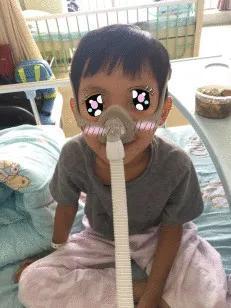 什么样的宝宝适合无创辅助通气治疗？