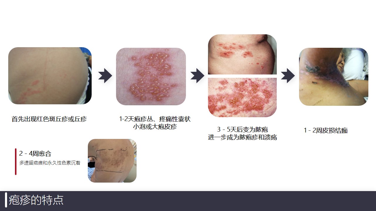 幻灯片12.JPG