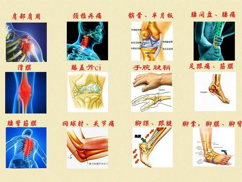疼痛1.jpg