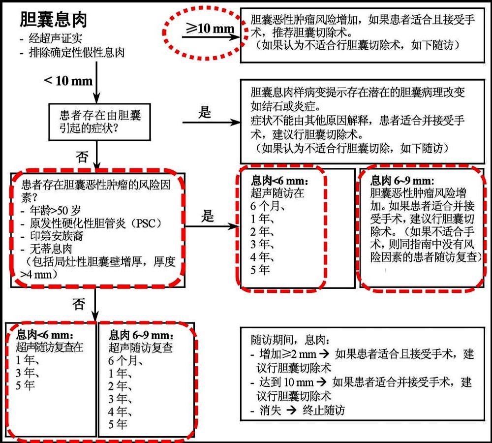 胆囊息肉诊治流程.jpg