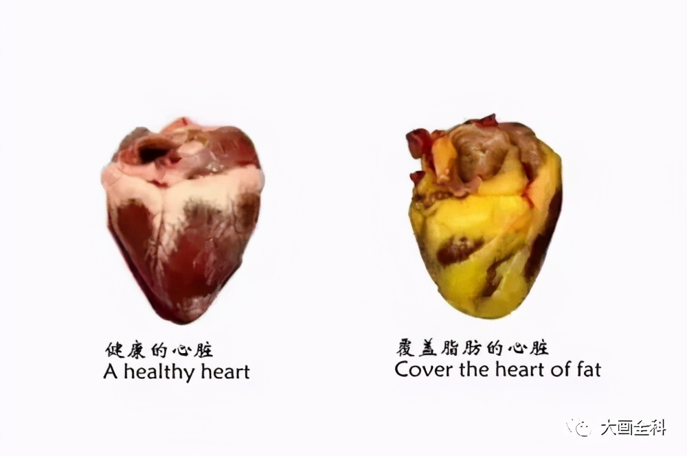“深藏不露”的内脏脂肪