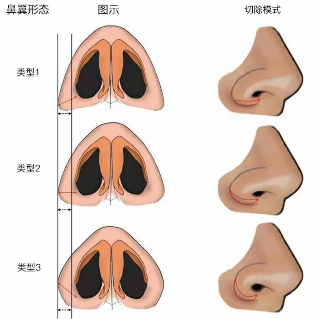 src=http_%2F%2Fkano.guahao.cn%2Fuy532246724.jpg_token=58138bc3c64cca34b21c21e3deb0a849&refer=http_%2F%2Fkano.guahao.jpg
