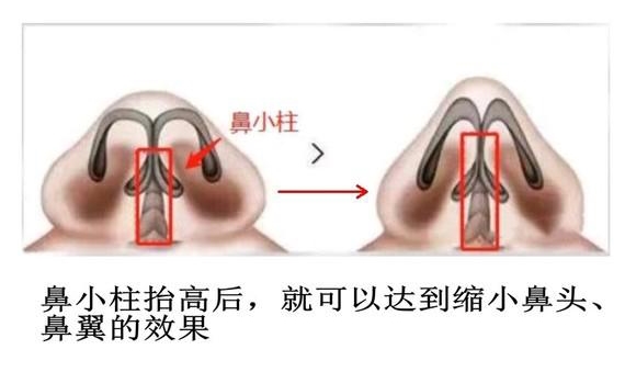 src=http_%2F%2Fimg2.soyoung.com%2Ftieba%2Fandroid%2Fpost%2F20181221%2F7%2F703da61ec2ff62ae62051954c0783188_570.jpg&refer=http_%2F%2Fimg2.soyoung_看图王.jpg
