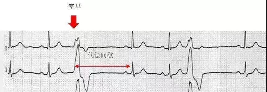 体检报告不会看指标？医学专家教你解读