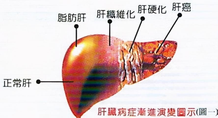 体检报告不会看指标？医学专家教你解读