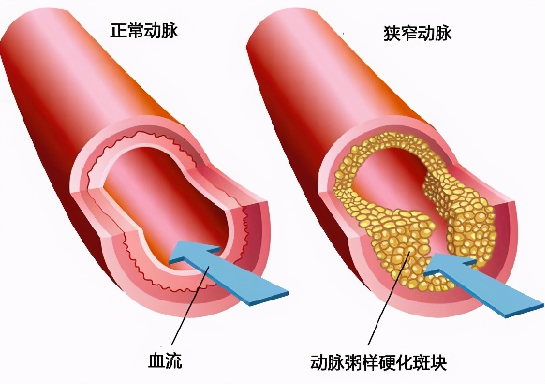体检报告不会看指标？医学专家教你解读