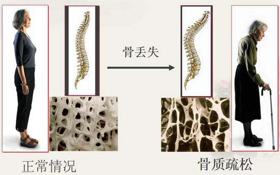 体检报告不会看指标？医学专家教你解读