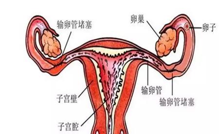 女人卵巢的位置示意图图片