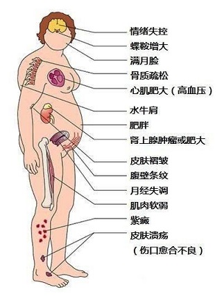 狼疮14.jpg