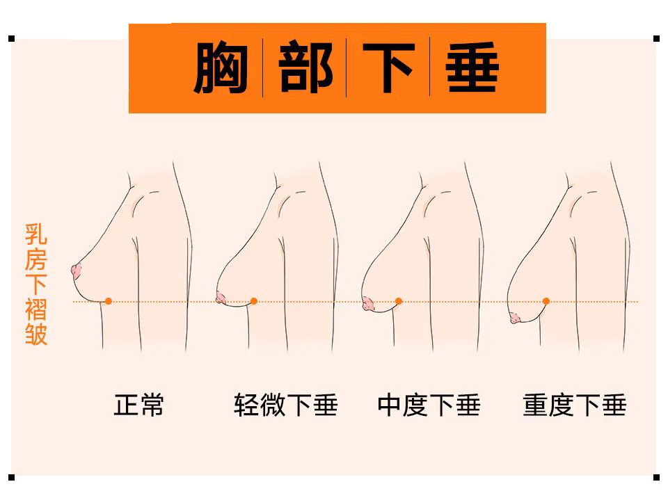 34b胸大约多大_大陷胸汤 小陷胸汤_34b的胸大还是小