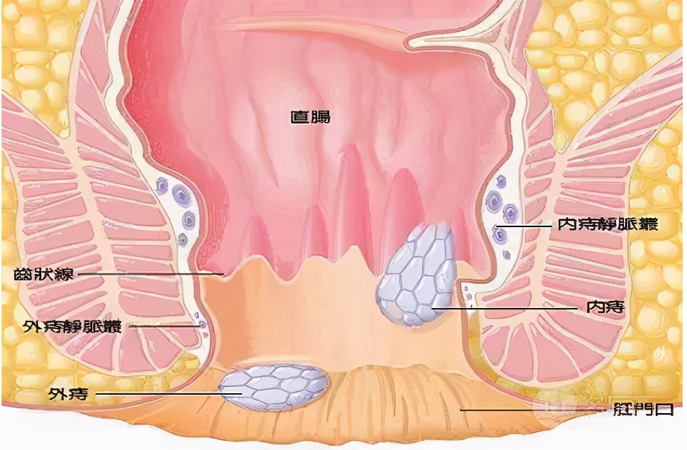 菊花残满地伤特色疗法帮您忙