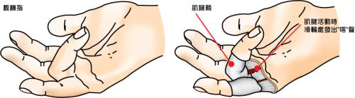弹响指-动漫2.png