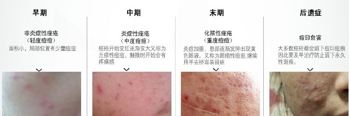 c269fa3cgd82a40067e0a&690.jpg