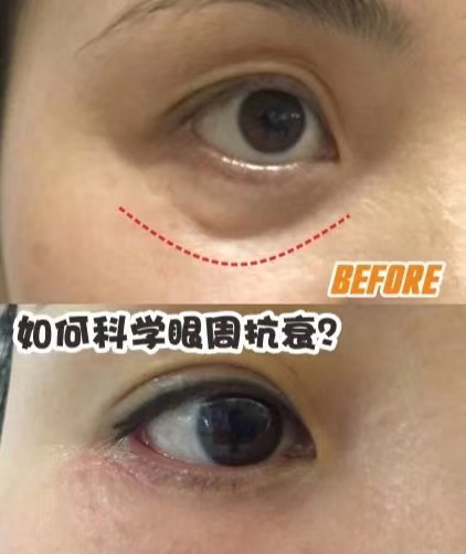 5a10e391884dd07a0f30b8fc2b55e57.jpg