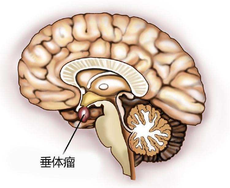 儿童脑垂体正常大小图片