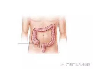 女性五症状，可能导致不孕