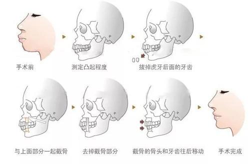 下载.jpg